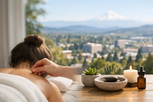 How to Choose a Beaverton Acupuncture Clinic