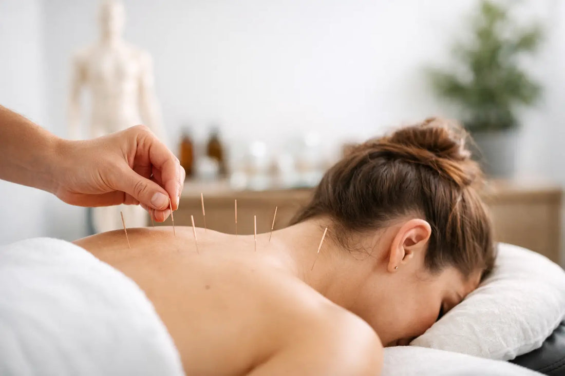 Acupuncture for Chronic Pain Examples That Help