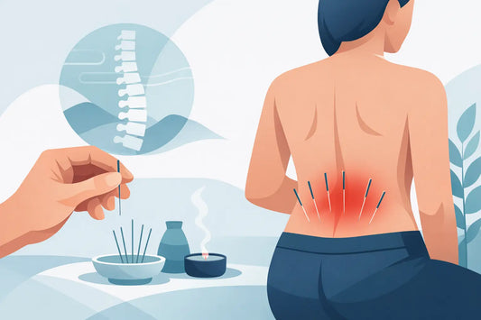 Does Acupuncture for Lower Back Pain Work?