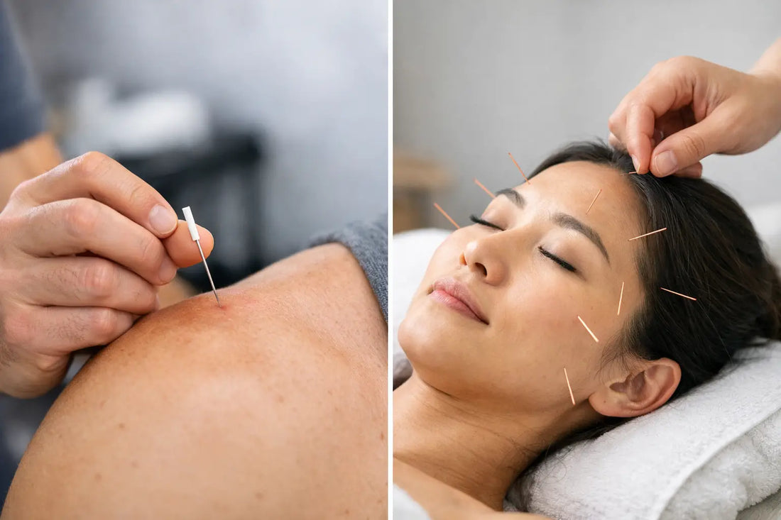 Dry Needling vs Acupuncture: Which Fits You?