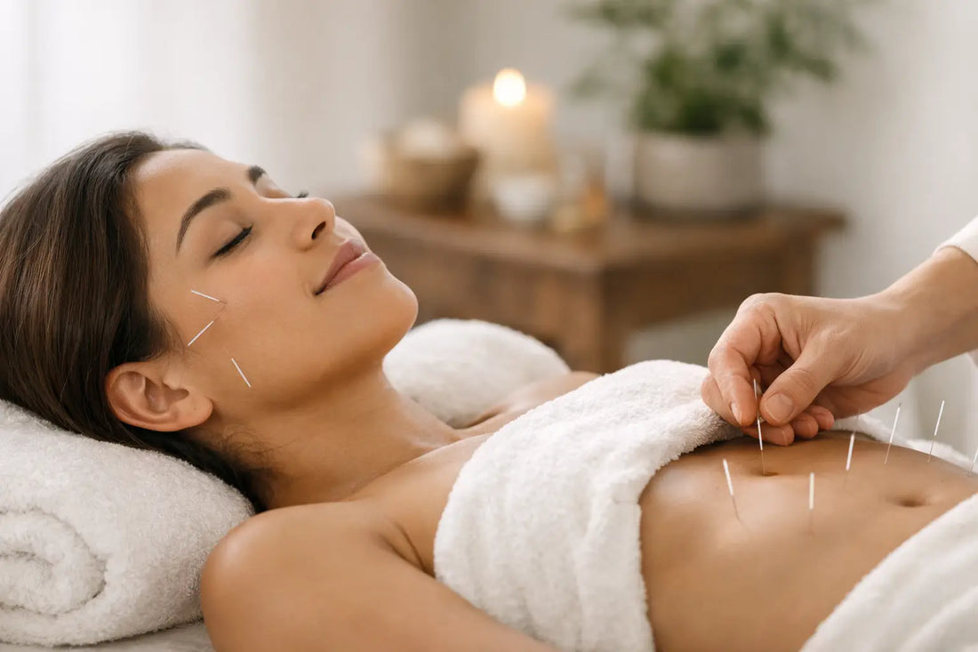 Can Acupuncture for PCOS Symptoms Support You?