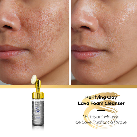 Secret Collagen Purifying Clay Lava Foaming Cleanser